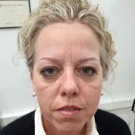 6_cejas_B
